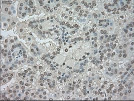 Monoclonal Mouse anti-Human NTRK3 / TRKC Antibody (clone OTI4E10, IHC, IF, WB)