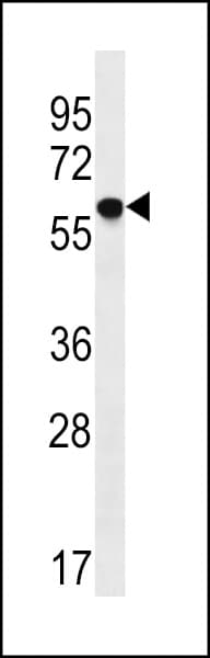 IHC-plus™ TM9SF2 Antibody (aa111-140)