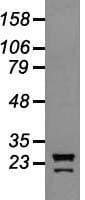 NEUROG1 / NGN1 / Neurogenin 1 Antibody (clone OTI3F9)