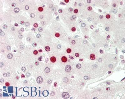 IHC-plus™ DOT1L / DOT1 Antibody (aa1008-1424, clone 1F1D4)