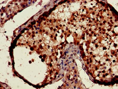 CSNK1A1 / CK1 Alpha Antibody