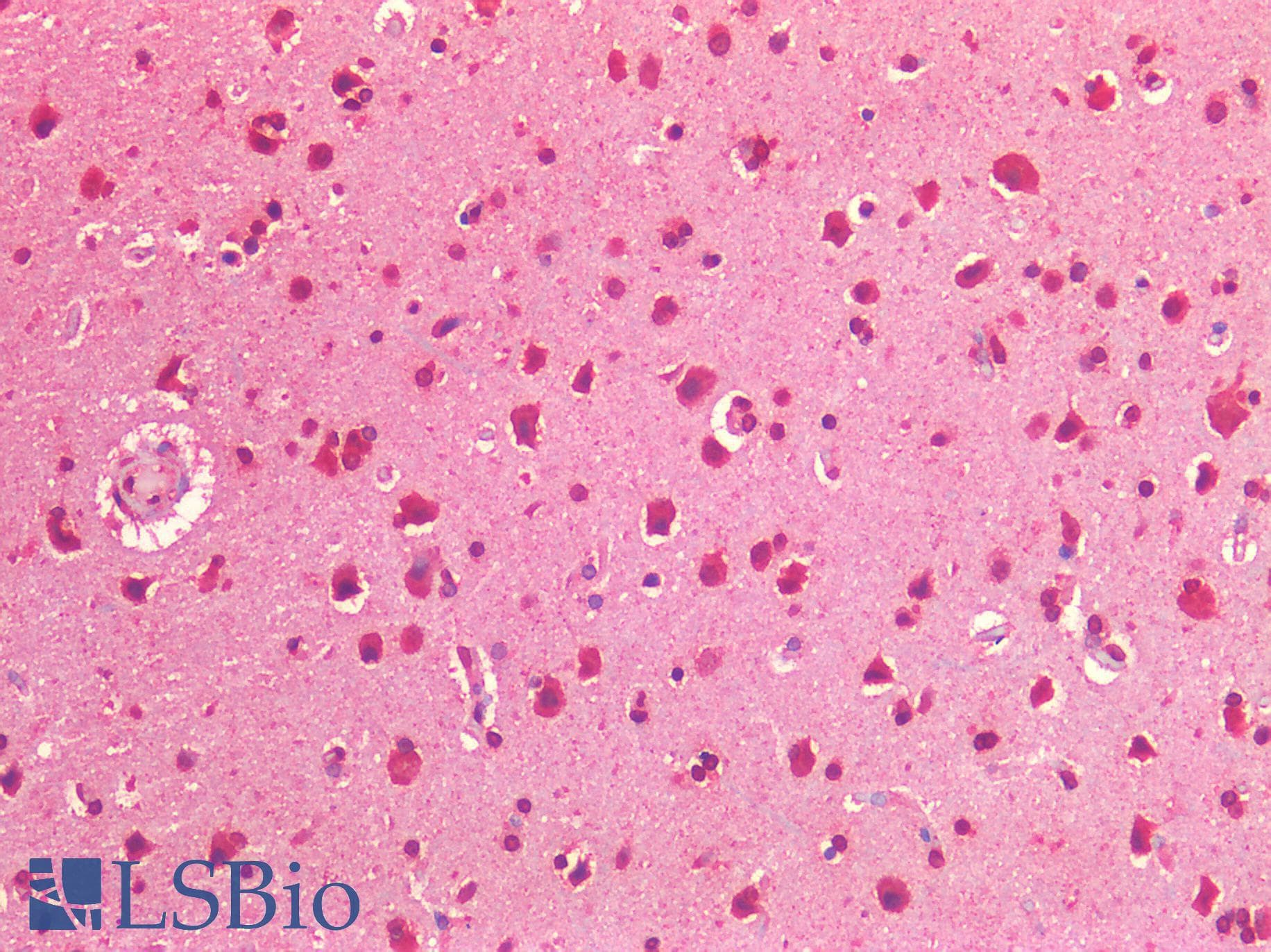 IHC-plus™ Polyclonal Rabbit anti-Human IGF1R / IGF1 Receptor Antibody (IHC)