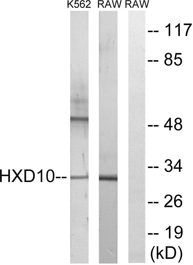 HOXD10 Antibody