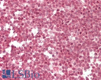 IHC-plus™ RBM22 Antibody (aa175-225)
