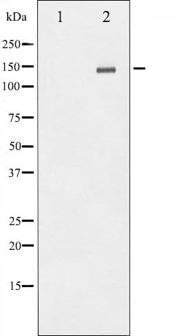 Polyclonal Rabbit anti-Human ERBB2 / HER2 Antibody (phospho-Tyr1112, IHC, IF, WB)