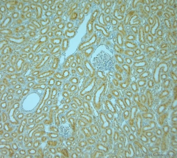 VAMP8 / VAMP-8 Antibody
