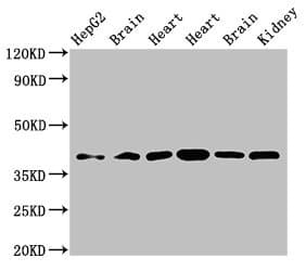 Polyclonal Rabbit anti-Human WISP3 Antibody (IHC, WB)