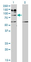 IL31RA Antibody (clone 3A10)