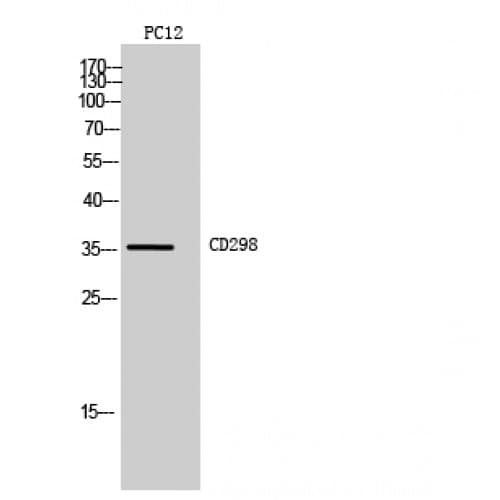 ATP1B3 Antibody (222-271 aa, C-terminal)