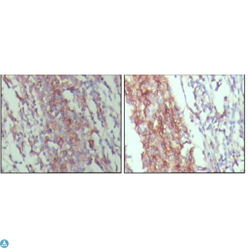 CD45 / LCA Antibody