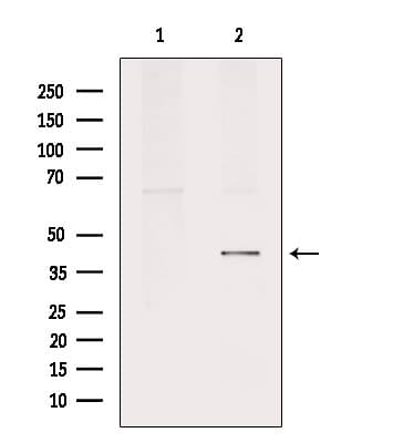 PTGER2 / EP2 Antibody