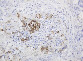 PTH / Parathyroid Hormone Antibody (clone OTI1C6)