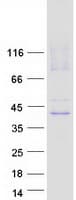 Human SLC29A1 / ENT1 Protein (Recombinant Myc-DDK (Flag))