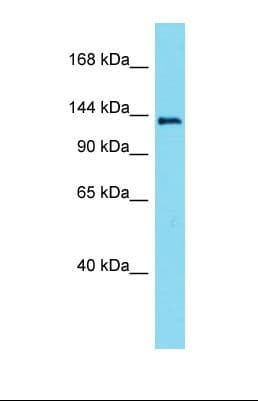 Polyclonal Rabbit anti-Mouse LMTK3 Antibody (aa1291-1340, WB)