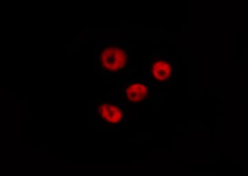 CHEK2 / CHK2 Antibody (phospho-Thr68)