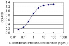 PRX-1 / PRRX1 Antibody (clone 1E2)