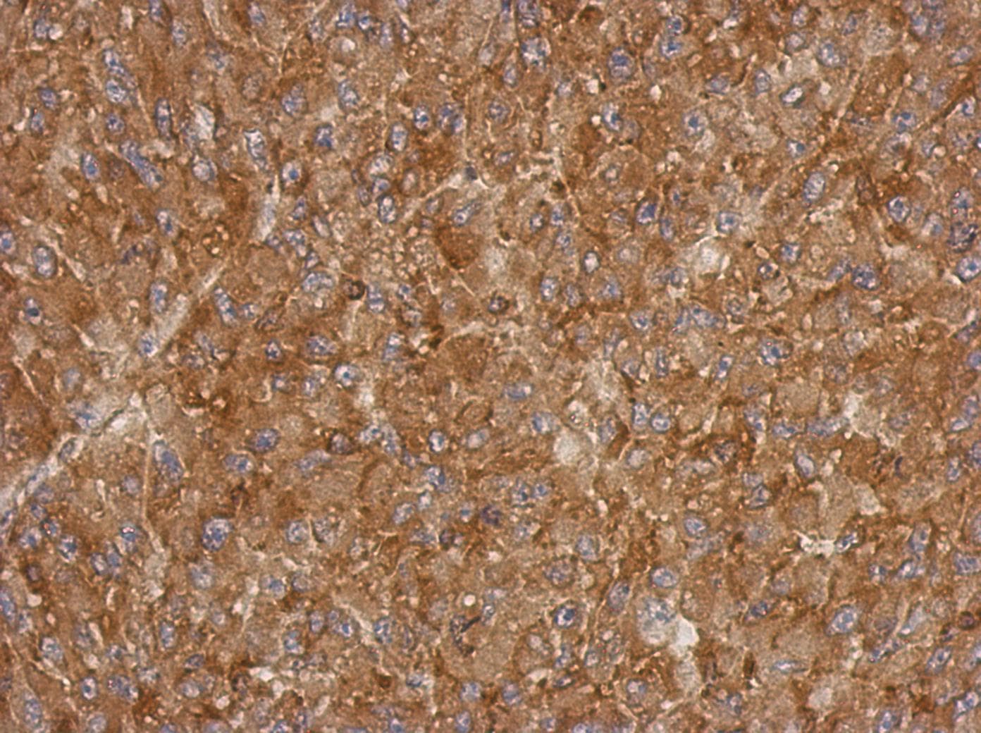 ACTRT1 Antibody