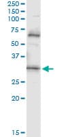 PDYN / ProDynorphin Antibody (clone 2E12)