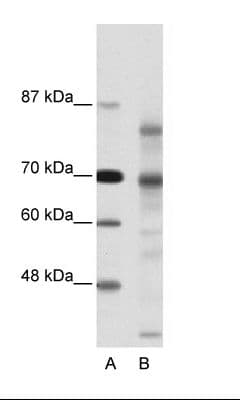 NCOR2 / SMRT Antibody (aa511-560, FITC)