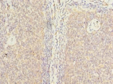 ZHX1 Antibody