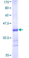 Human HUWE1 / ARFBP1 Protein (Recombinant GST, N-terminus)