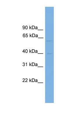 Polyclonal Rabbit anti-Human PVRL3 / Nectin-3 Antibody (aa467-516, IHC, WB)