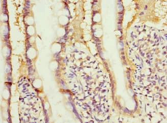 RBP2 / CRBPII Antibody