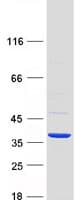 Human RDHE2 / SDR16C5 Protein (Recombinant Myc-DDK (Flag))