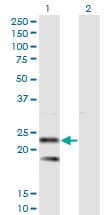 Monoclonal Mouse anti-Human SSR2 Antibody (clone 4C1, IF, WB)