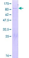Human FRS3 Protein (Recombinant GST)