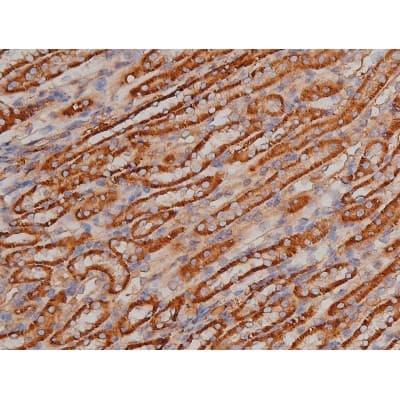 Polyclonal Rabbit anti-Human SP1 Antibody (phospho-Thr739, IHC, IF, WB)