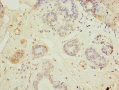 Polyclonal Rabbit anti-Human HEATR9 Antibody (IHC, WB)