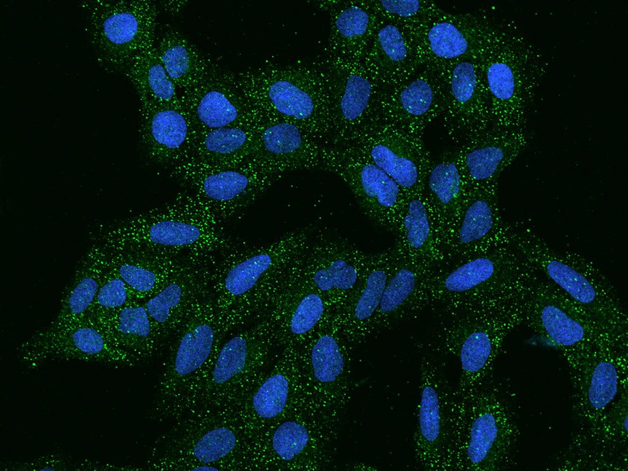 AG3 / AGR3 Antibody
