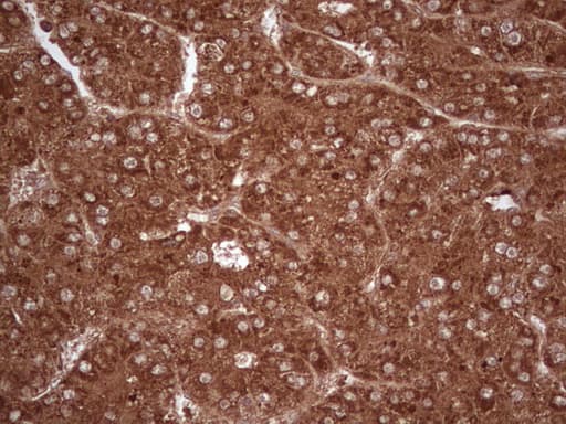 UBE2D2 / UBCH5B Antibody (clone OTI1D11)