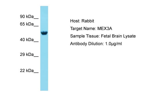 Polyclonal Rabbit anti-Human MEX3A Antibody (aa172-221, WB)
