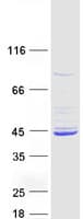 Human MCAT Protein (Recombinant Myc-DDK (Flag))