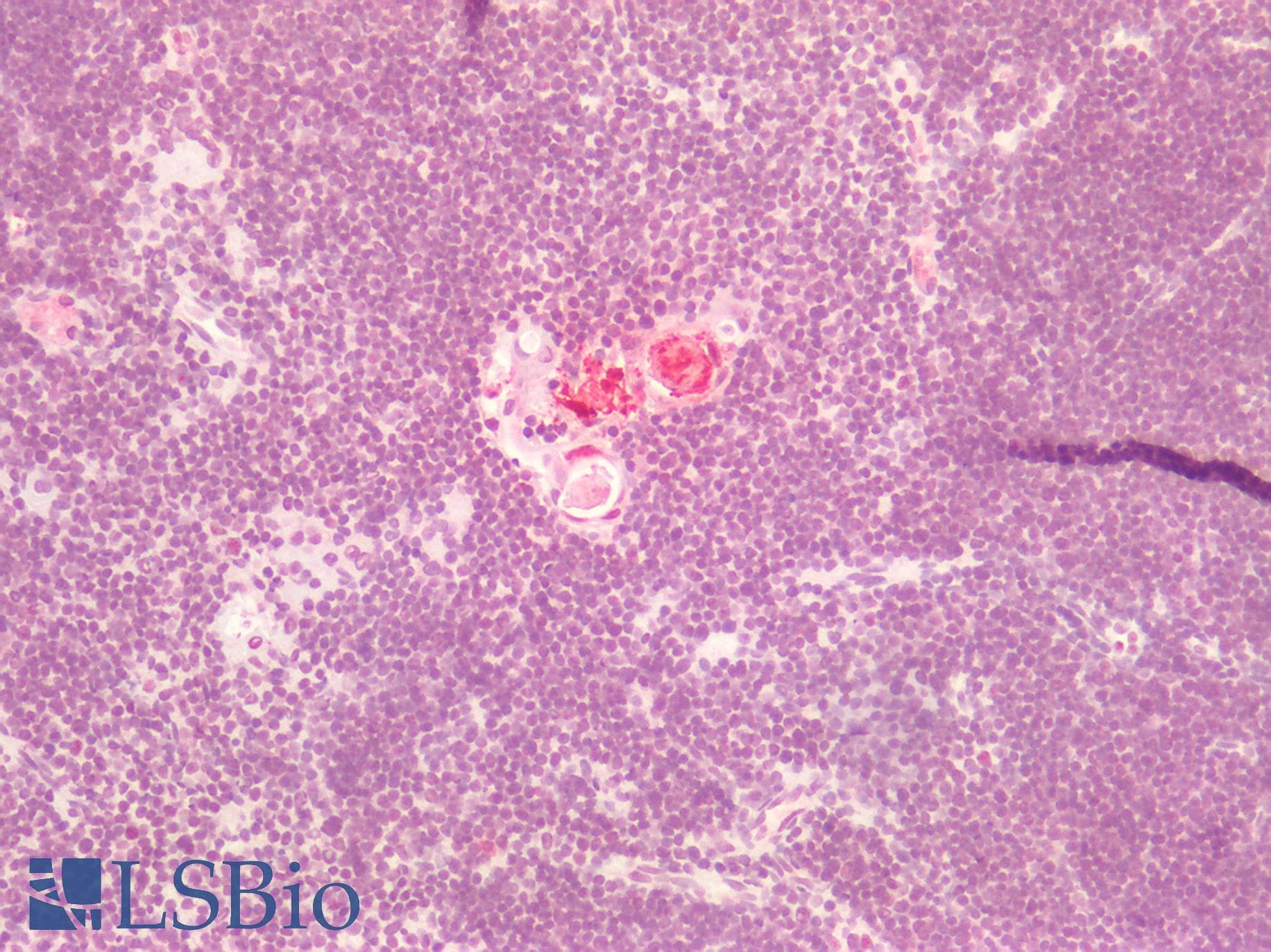 IHC-plus™ Monoclonal Mouse anti-Human S100A8 / MRP8 Antibody (clone CF-145, FITC, IHC, IF, WB)