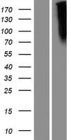 FZD10 / Frizzled 10 Protein (Over-Expression Lysate Myc-DDK (Flag))
