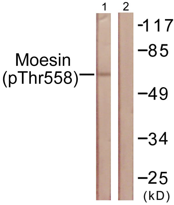 Ezrin + Radixin + Moesin Antibody (phospho-Thr558)