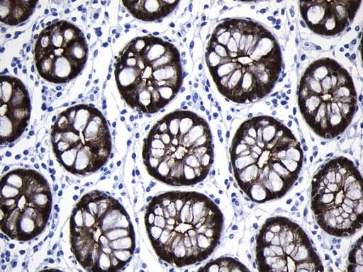 Monoclonal Mouse anti-Human VIL1 / Villin Antibody (clone UMAB230, Carrier-free, aa1-188, IHC)