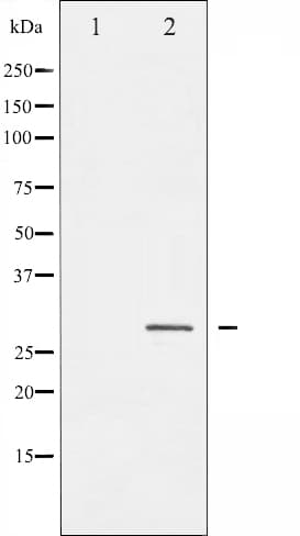 HSPB1 / HSP27 Antibody (phospho-Ser82)