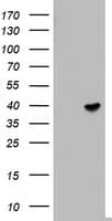 TEL-2 / ETV7 Antibody (aa90-341, clone OTI3B2)