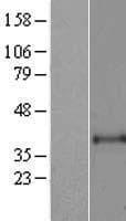 ART1 /CD296 Protein (Over-Expression Lysate Myc-DDK (Flag))