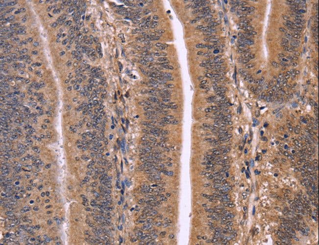 CLUAP1 Antibody