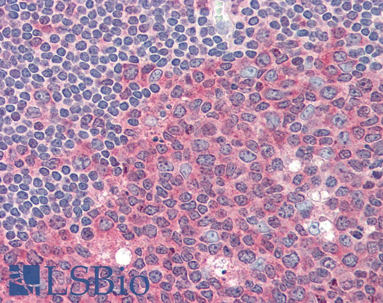 IHC-plus™ PKM / Pyruvate Kinase, Muscle Antibody