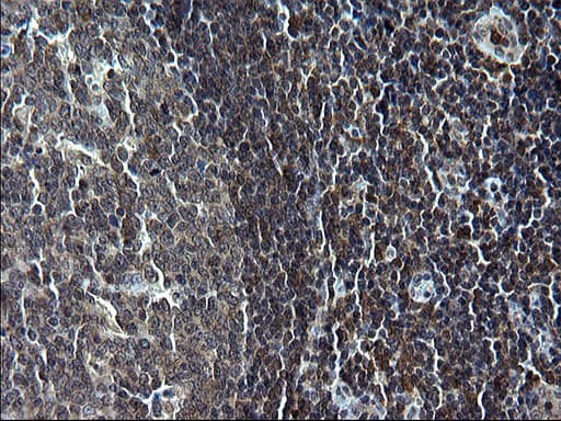 Monoclonal Mouse anti-Human IRF5 Antibody (clone OTI1G7, IHC, WB)