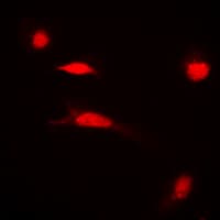 Polyclonal Rabbit anti-Human Histone H3 Antibody (Acetyl-Lys27, IHC, IF, WB)