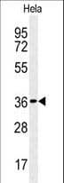 Polyclonal Rabbit anti-Human CTDSPL Antibody (aa1-30, WB)