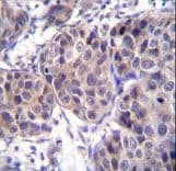 DVL3 / Dishevelled 3 Antibody (aa530-557)