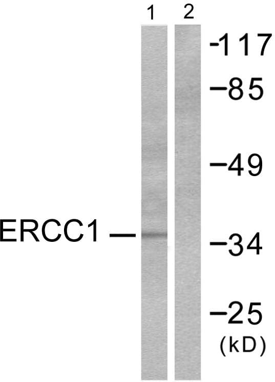 Polyclonal Rabbit anti-Human ERCC1 Antibody (IHC, WB)
